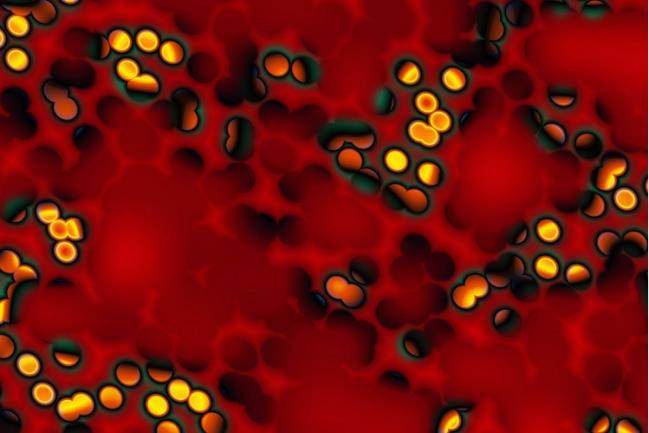 A selected image which represents the Arden & GEM to host NICOR clinical audits & registries item